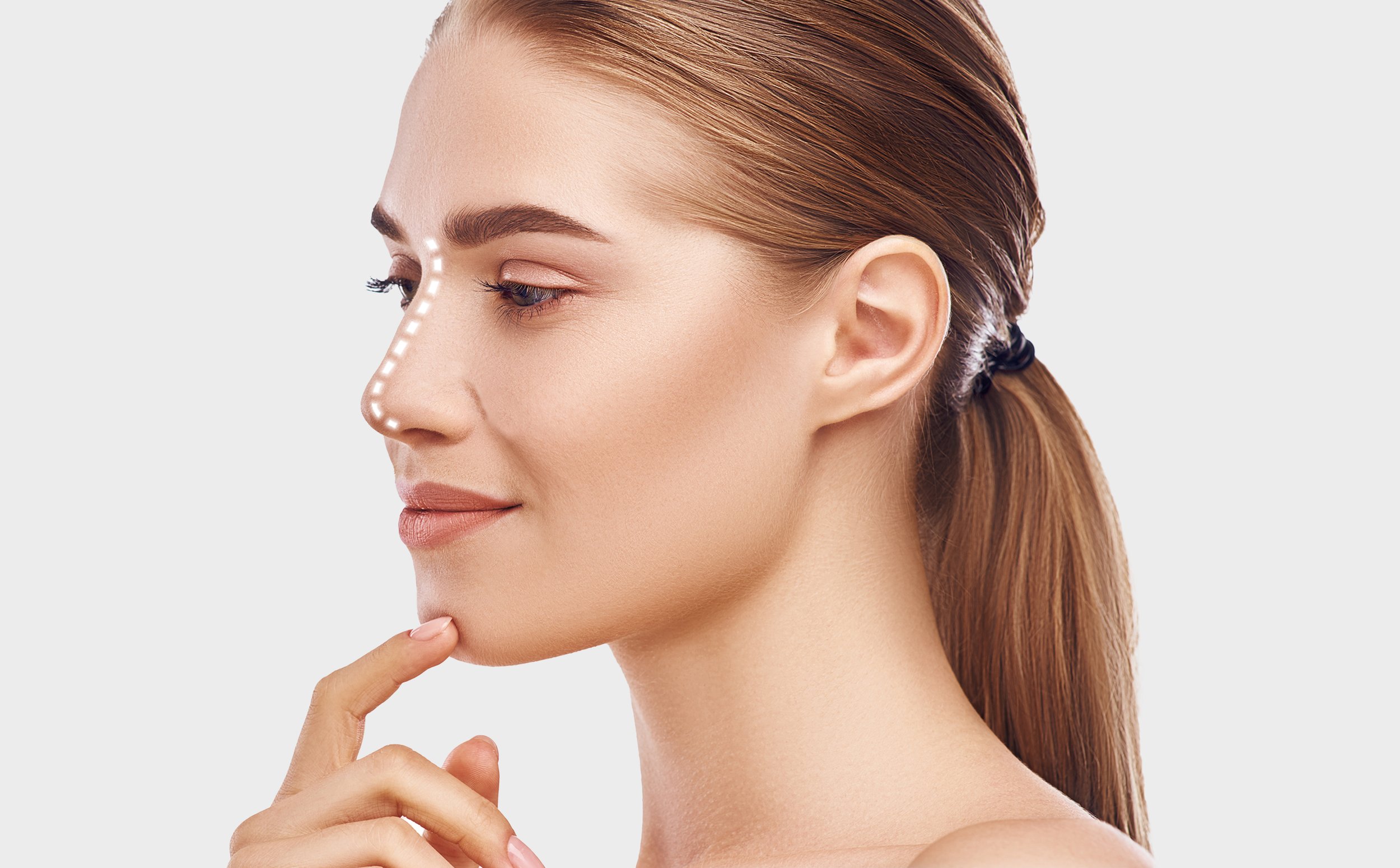 Hiko Nose Thread Lift: A Comprehensive Guide to the Procedure