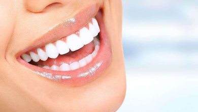 teeth whitening in Abu Dhabi