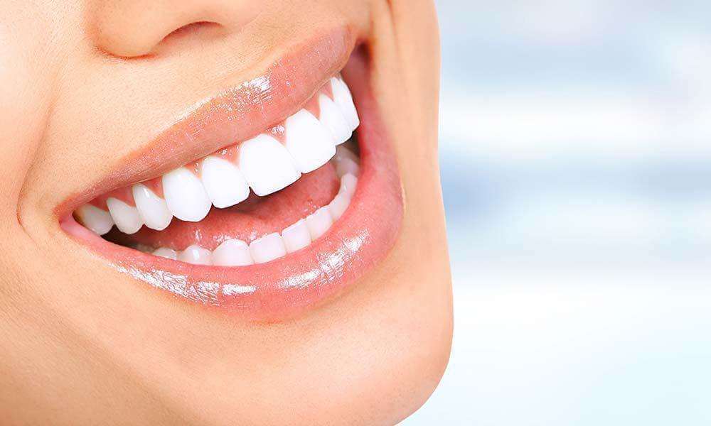 teeth whitening in Abu Dhabi